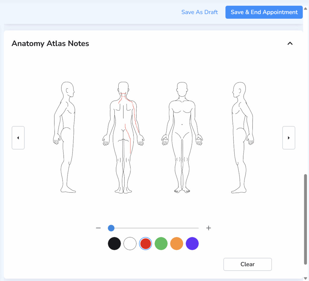 Interactive anatomy diagram used to visually mark and document patient pain locations during a clinical visit.