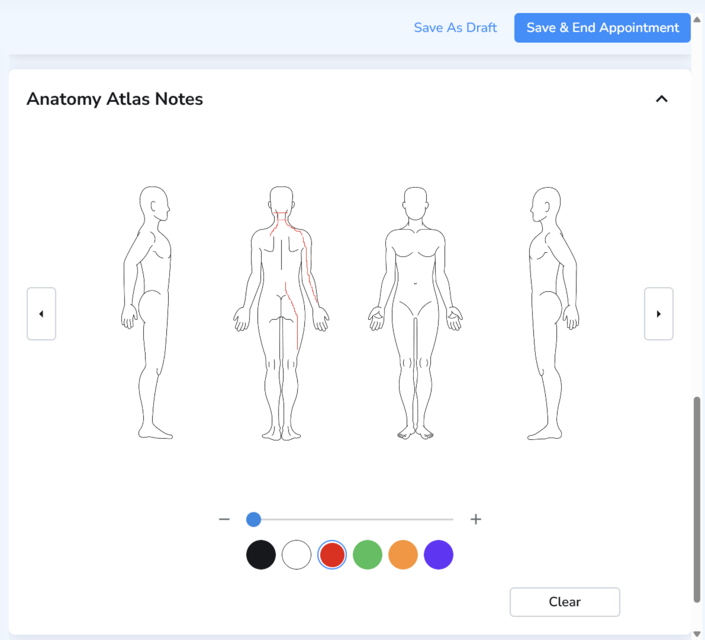 Draw on anatomical diagrams