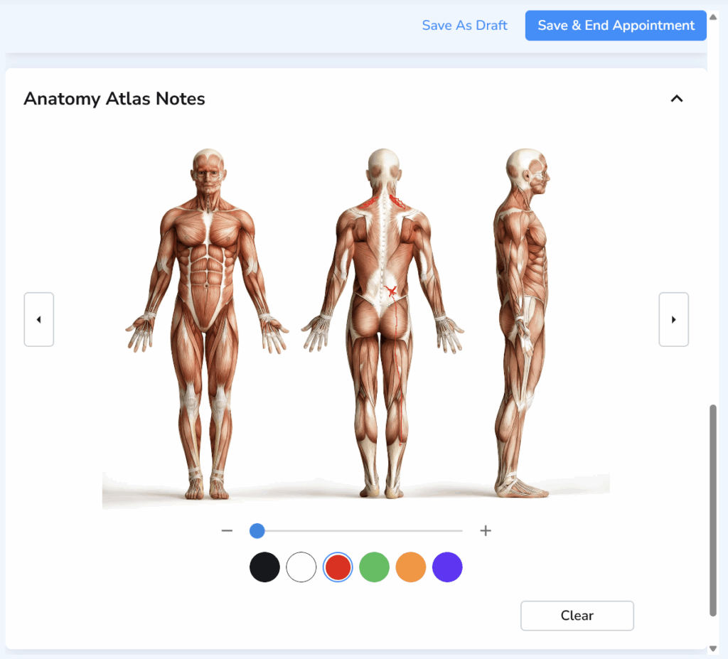 Detailed muscle anatomy atlas used to visually mark patient pain patterns and symptom distribution during a clinical visit.
